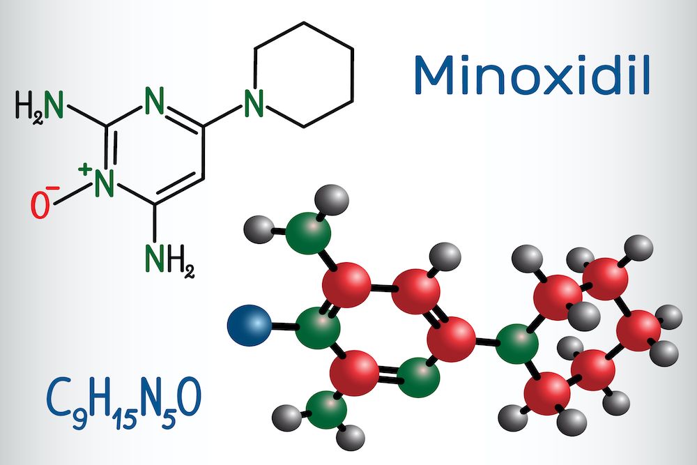 Minoxidil, eficacia y efectos secundarios